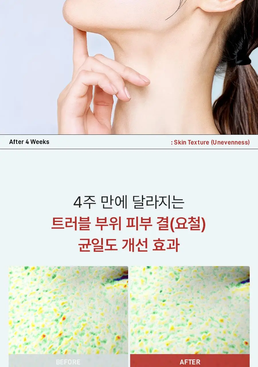 [트러블진정템] 더마젼시 제로카 81 크림 60ml 상세페이지 11